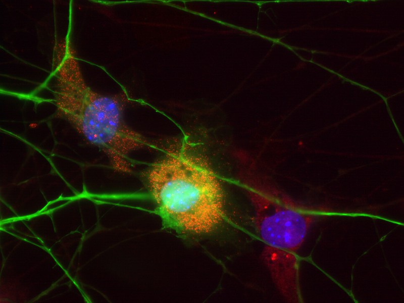 Simultaneous RNA FISH and immunofluorescence