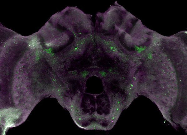 Stellaris RNA FISH in whole mount