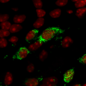 stellaris rna fish mouse brain plp1 zoomed in